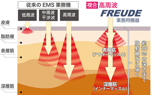 整骨院・サロンの売り上げアップなら業務用EMS「フロイデ」